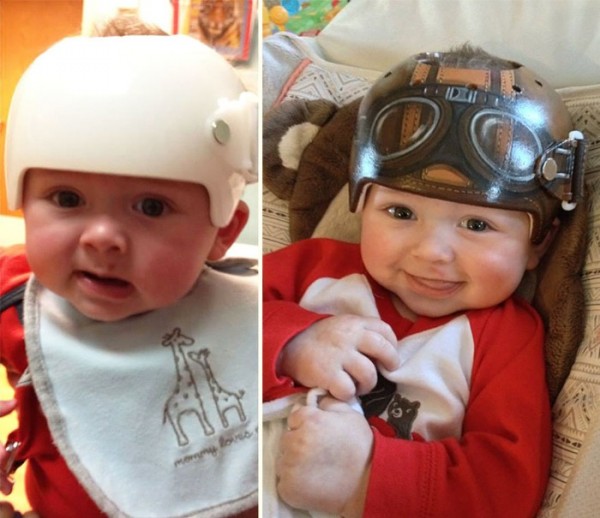 casco-corrector-bebes-pintado-00