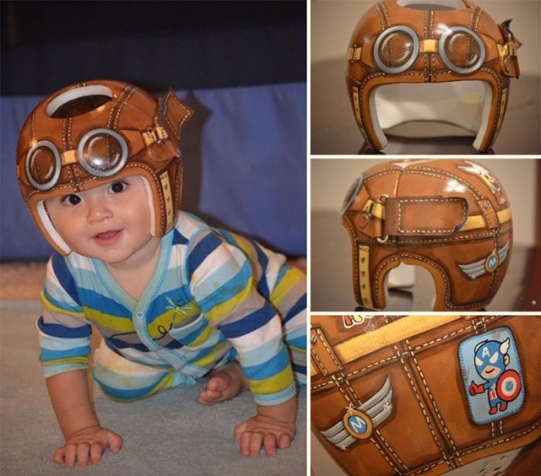 casco-corrector-bebes-pintado-01
