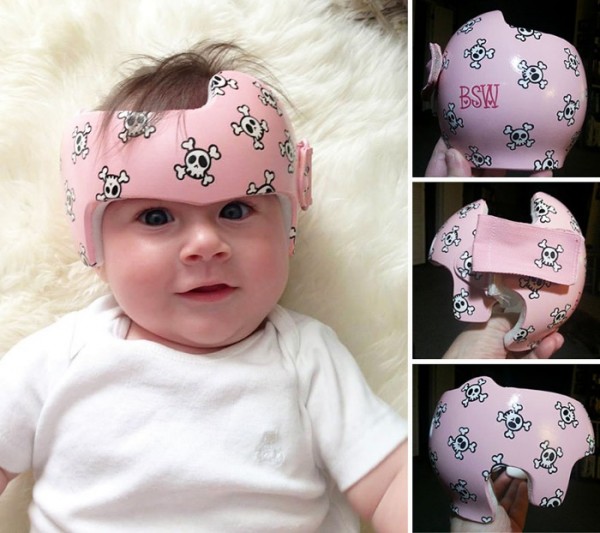 casco-corrector-bebes-pintado-09
