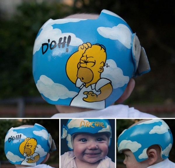 casco-corrector-bebes-pintado-16